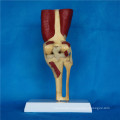 Medical Teaching Knee Joint Skeleton Anatomy Functional Model (R040105)